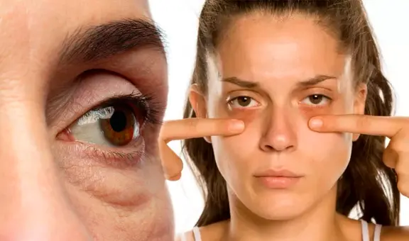 La poderosa planta que reduce la flacidez en la piel, ojeras y bolsas en los ojos