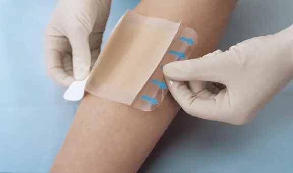 Científicos chinos crean parche que cambia de color ante infecciones por superbacterias