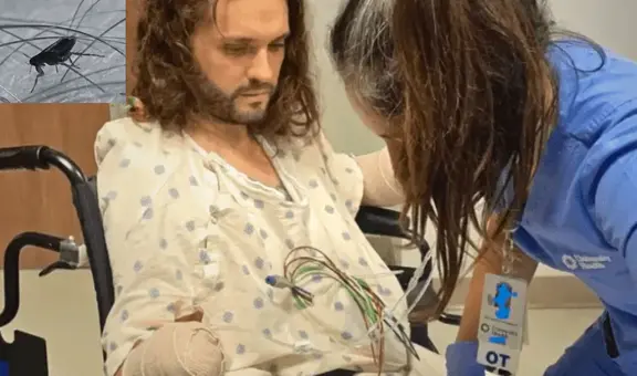 Sufre la picadura de una pulga, va al hospital de emergencia y le amputan las manos y los pies