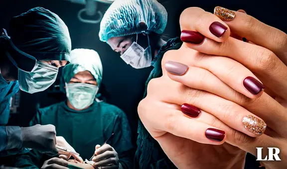 ➤Las razones por las que no debes llevar uñas pintadas a sala de operaciones