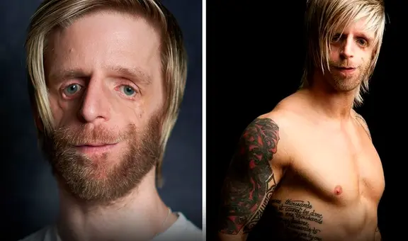 La historia de Jono: fue abandonado al nacer por una enfermedad hereditaria, y ahora triunfa como modelo