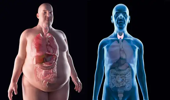 ¿Qué significa tener hipotiroidismo y cuáles son sus síntomas?