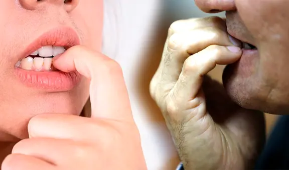 ¿Te muerdes las uñas mucho? Un estudio finalmente dio la técnica definitiva para dejar esta mania