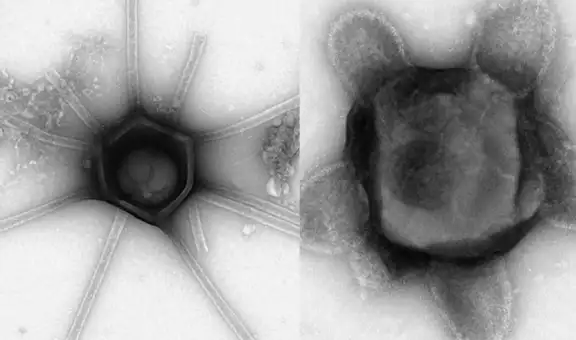 Científicos de EE. UU. descubren virus gigantes con brazos y colas nunca antes vistos
