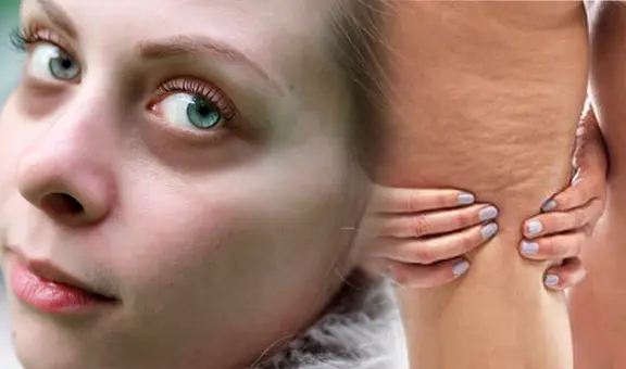 Mejora la apariencia de tus ojeras y reduce la celulitis con esta VITAMINA natural