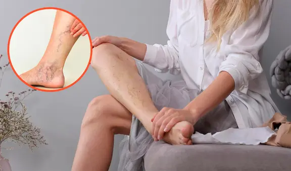 Esta vitamina mejora tu circulación sanguínea naturalmente