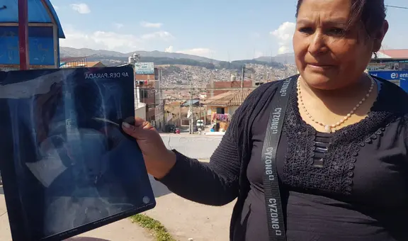 Madre denuncia bullying después de que su hija sea hospitalizada tras ingerir grapa en colegio de Cusco