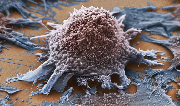 Científicos logran convertir tumores cancerosos en células sanas con tecnología genética