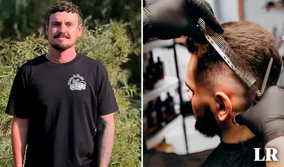 Joven va a cortarse el cabello y descubre que tiene cáncer de piel: le quedan 6 meses de vida