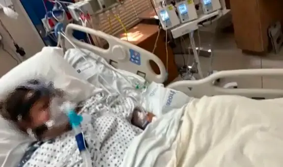 Le amputan todas sus extremidades luego de contraer infección por comer pescado semicocido