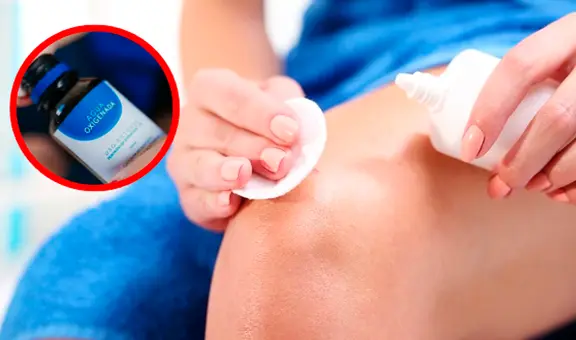 ¿Por qué no debes usar AGUA oxigenada para desinfectar tus heridas? Conoce la razón