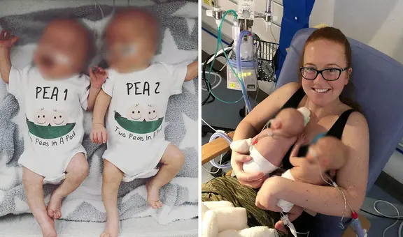 La insólita historia de una mujer que dio a luz a cada uno de sus mellizos con 2 días de diferencia