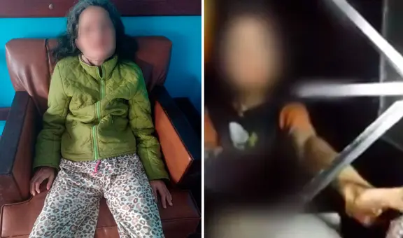 Caso Chanita: así se recupera la mujer que vivió abandonada sin comida ni servicios básicos