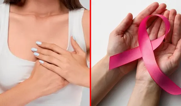 Cáncer de mama: ¿cómo practicarse un autoexamen y por qué es importante realizarse un chequeo?
