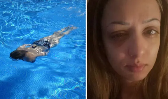 Mujer acudió a nadar a piscina pública y perdió la visión en un ojo: “El dolor más insoportable”