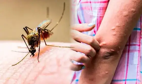 ¿Por qué hay tantos mosquitos en Arequipa y qué hacer para protegernos de ellos?