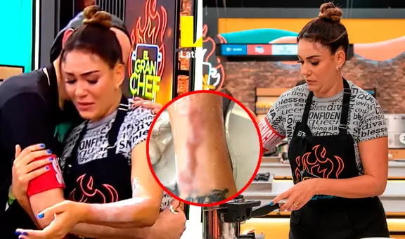 Tilsa Lozano sufrió fuerte quemadura de segundo grado en 'El gran chef: famosos'