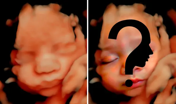 Usan tecnología de IA en ecografías de bebés para adivinar cómo serán sus rostros al nacer