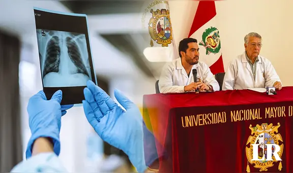Director de clínica universitaria de San Marcos: "No hay brote de tuberculosis en la UNMSM"