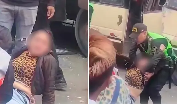 San Juan de Lurigancho: mujer herida en triple choque vehicular podría perder las piernas