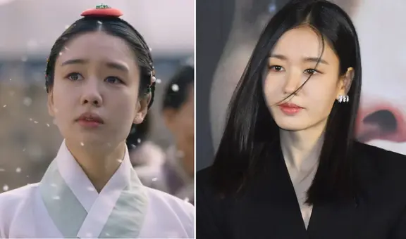 ‘My Dearest’: Ahn Eun Jin revela que sufrió parálisis facial durante el rodaje de k-drama