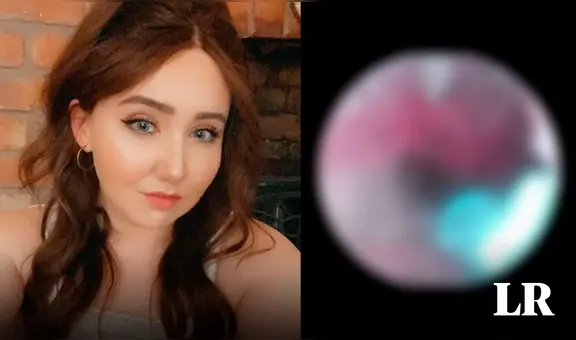 Mujer descubre un nido de arañas dentro de su oído luego de escuchar “crujidos” por semanas