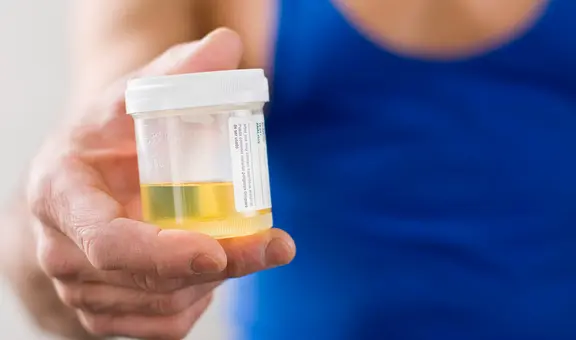 Descubren, por fin, el misterio de por qué la orina es de color amarillo