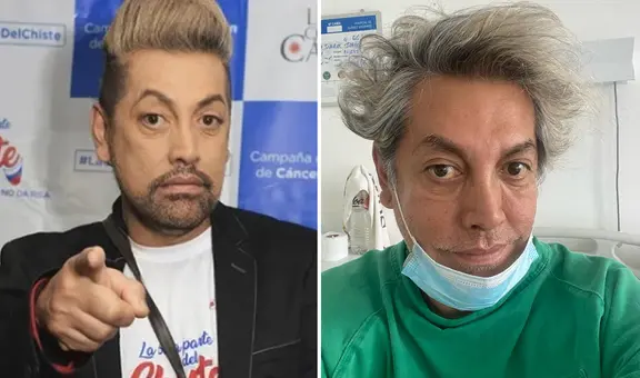 Koky Belaunde sobrevivió a dificil operación de riesgo: ¿qué pasó con el famoso maquillador?