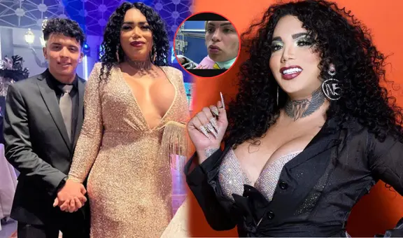 Paola Suárez es internada de emergencia tras agresión: ¿qué pasó con la integrante de ‘Las Pérdidas’?