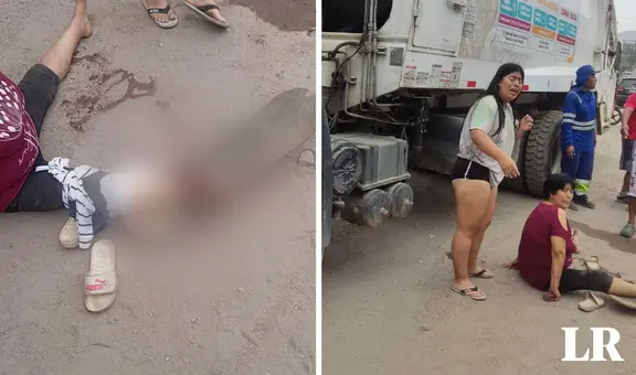 SJL: camión de basura atropella a mujer y ahora corre peligro de que le amputen el pie