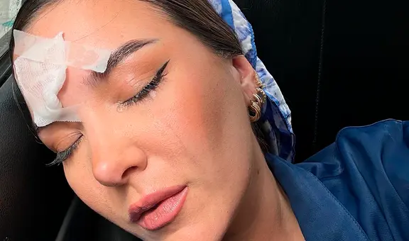 Ale Fuller sufre accidente durante grabación de 'El gran chef famosos: la revancha' y preocupa a fans