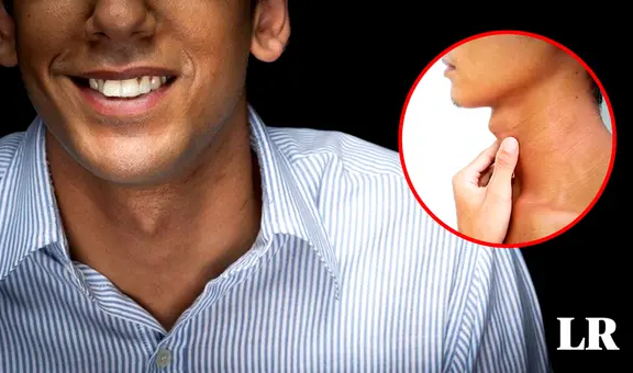 ‘Manzana de Adán’: ¿qué es y por qué las mujeres no lo tienen?