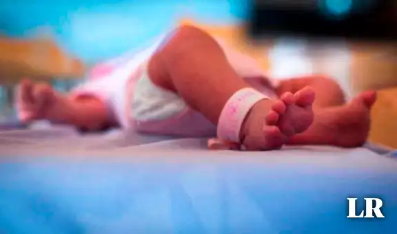 Niña nació sin ojos pese a que exámenes no arrojaban condición: es uno de los 30 casos en el mundo