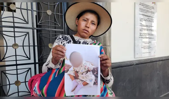 Madre pide apoyo para su hija internada tras accidente mientras jugaba, en Arequipa