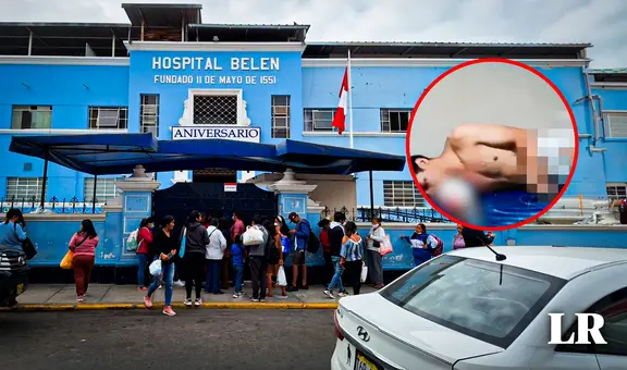 Trujillo: extorsionador pierde la mano al intentar detonar explosivo en casa de soldador