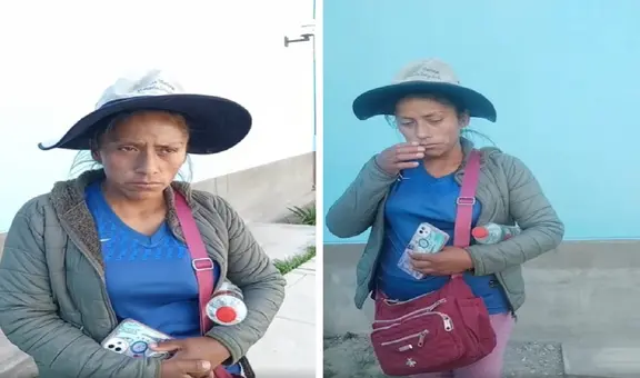 Madre necesita 70.000 soles para reconstruir rostro de su hijo, quien sufrió accidente en Arequipa