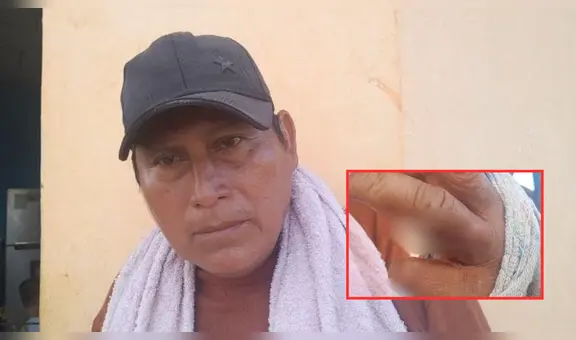 Iquitos: hombre ataca con cuchillo a vecino porque se negó a darle S/2 para comprar trago