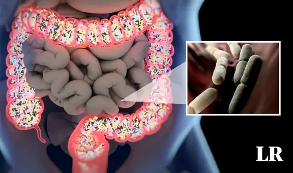 Mujer seguía emborrachándose sin motivo: el peligroso síndrome de los hongos que crean alcohol