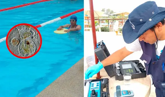 Alerta por ameba 'comecerebros' en Perú: esto se sabe de la enfermedad detectada en el país luego de 10 años