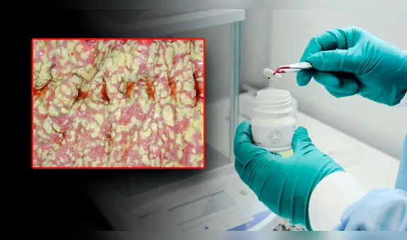 Conoce a MBK-01, la pastilla de heces fecales que reemplazará a los antibióticos contra infecciones graves