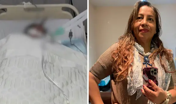 Mujer regresa a Perú desde los EE. UU. para someterse a liposucción y muere tras días de agonía