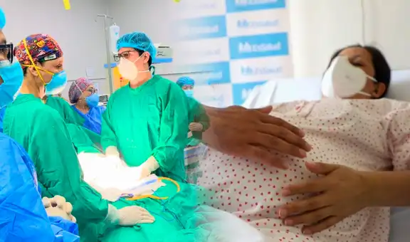 Cesáreas en Perú: ¿qué factores contribuyen a que más mujeres opten por este procedimiento?