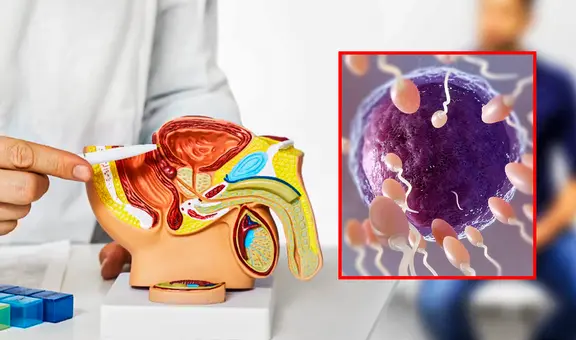 Eyacular al menos 21 veces al mes reduce el riesgo de padecer cáncer de próstata, según estudio de Harvard