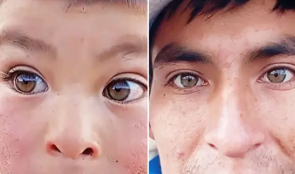 Peruano muestra los ojos ‘hazel’ de su familia y usuarios dicen: “Yo heredé miopía y astigmatismo”