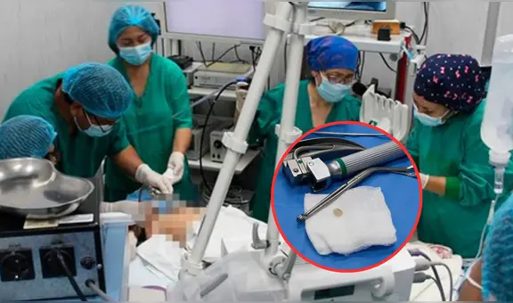 Niño de 1 año se salva de morir tras atorarse con frijol: tuvo que viajar de Satipo a Lima para ser operado