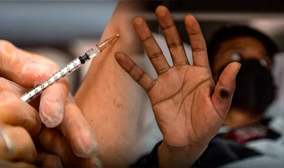 Los casos de mpox en Perú en 2024 y qué se sabe de la vacuna contra el virus, según el Ministerio de Salud