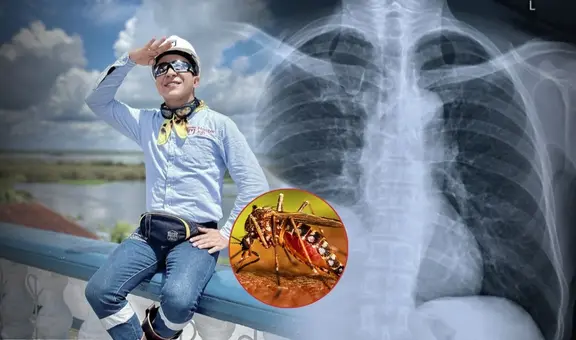 ¿Qué es el derrame pleural?: La complicación por dengue que acabó con la vida del 'Ingeniero Bailarín' a sus 34 años