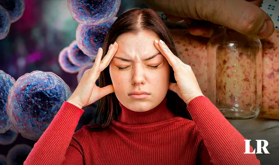 Meningitis meningocócica en rápido aumento en el Perú: qué es, cómo se contagia y cuáles son los síntomas de la enfermedad