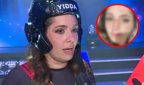 Yiddá Eslava REVELA que se fracturó la nariz luego de FUERTE golpe en 'EEG': "No puedo escapar de la operación"