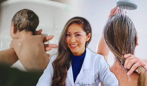 ¿Cada cuánto es recomendable bañarse? Una médica dermatóloga peruana revela: "El baño debe durar entre 1 a 5 minutos"